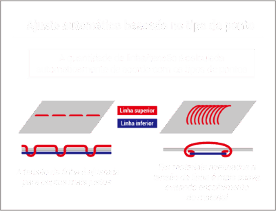 I-TM tipo de ponto